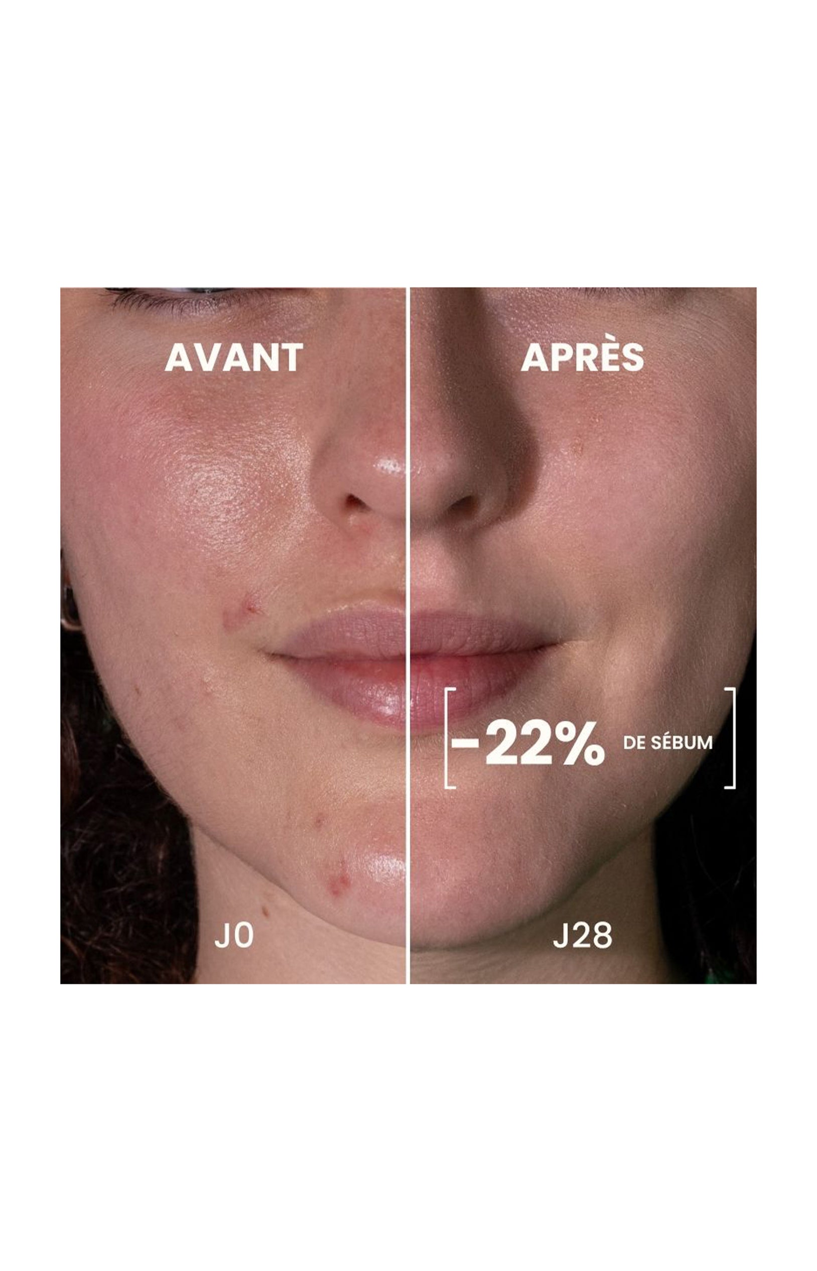 Sérum anti-imperfections bio - Visage - 30 ml