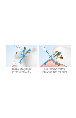 Fil & irrigateur dentaire sans fil