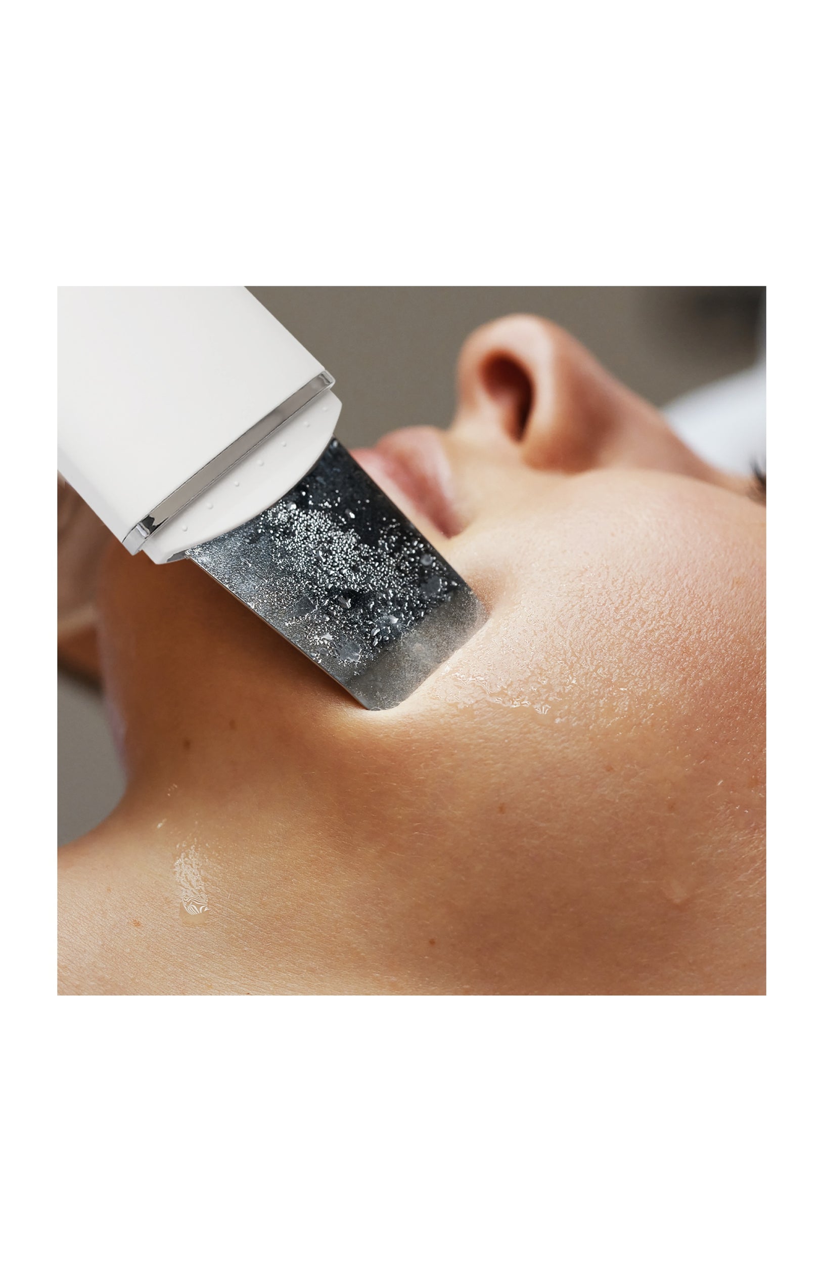Spatule ultrasonique nettoyante - Exfoliation & soin - Visage