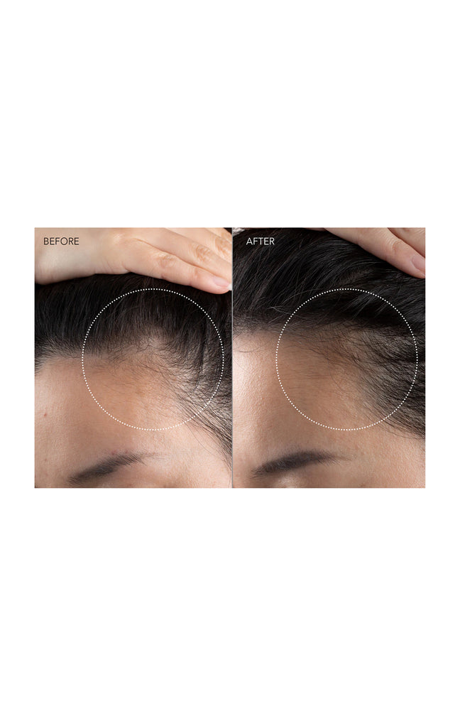 FAQ™ 301 - Appareil de massage stimulateur de pousse - Cheveux