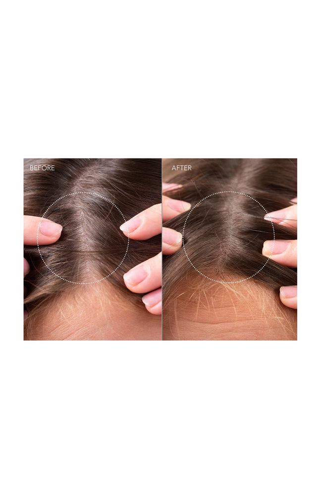 Sérum probiotique régénérant - FAQ™ Scalp Recovery - Cheveux