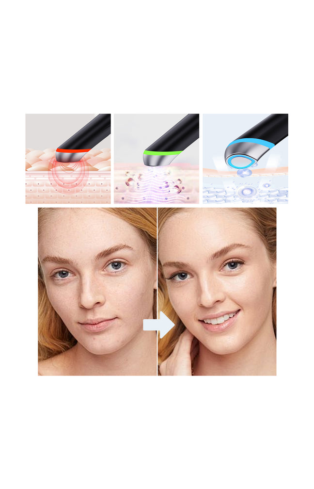 Appareil beauté 4-en-1 - Visage - Noir