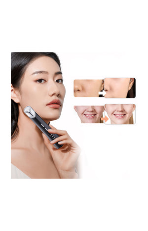 Appareil beauté 4-en-1 - Visage - Noir