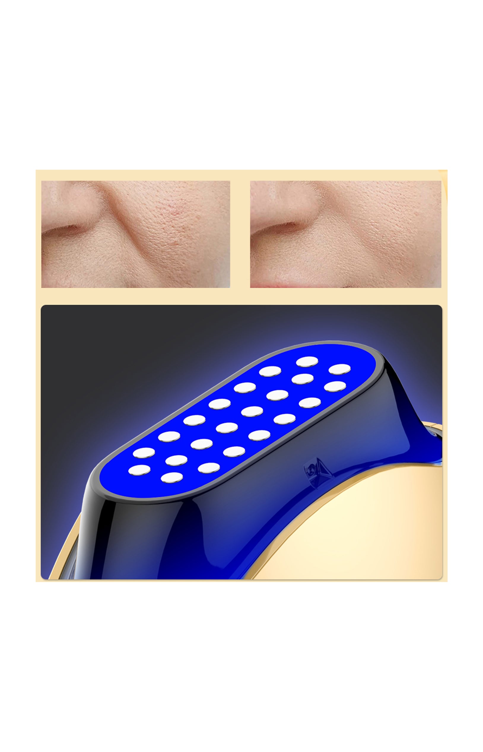 Appareil revitalisant - Visage - Doré