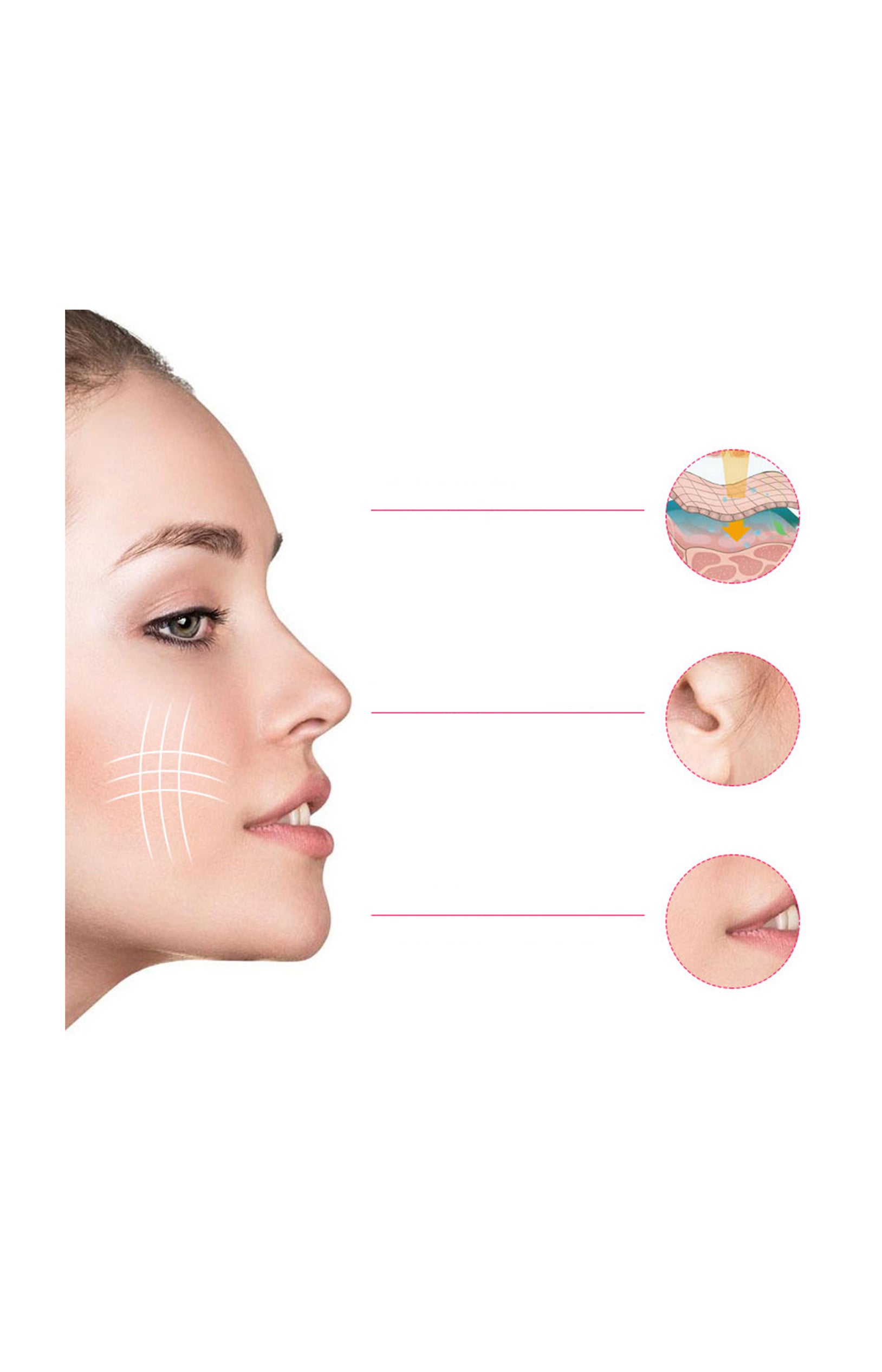 Appareil raffermissant par électrostimulation - Visage - Blanc