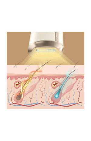 Épilateur lumière pulsée IPL - Corps & visage
