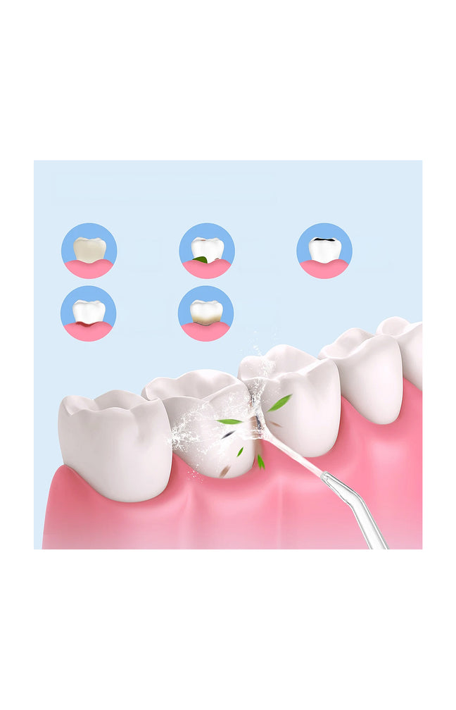 Hydropulseur buccal - Rose