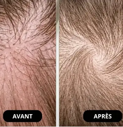 Shampoing Réparateur Acides Aminés - Nettoie Sans Assécher la Fibre
