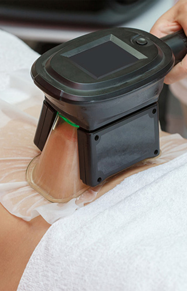 5 séances de cryolipolyse