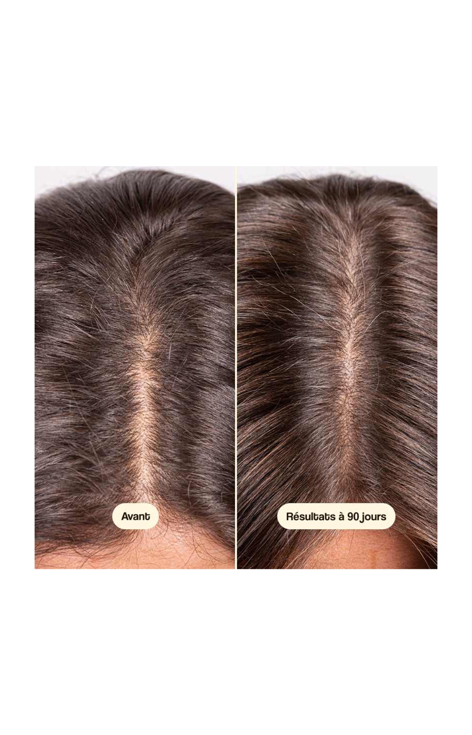 Sérum cheveux - Croissance & densité - 50 ml