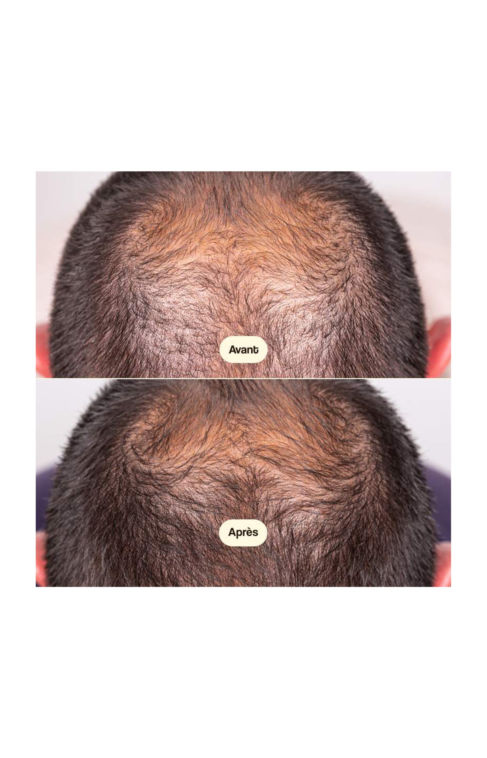 Sérum cheveux - Croissance & densité - 50 ml