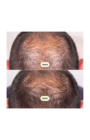 Sérum cheveux - Croissance & densité - 50 ml