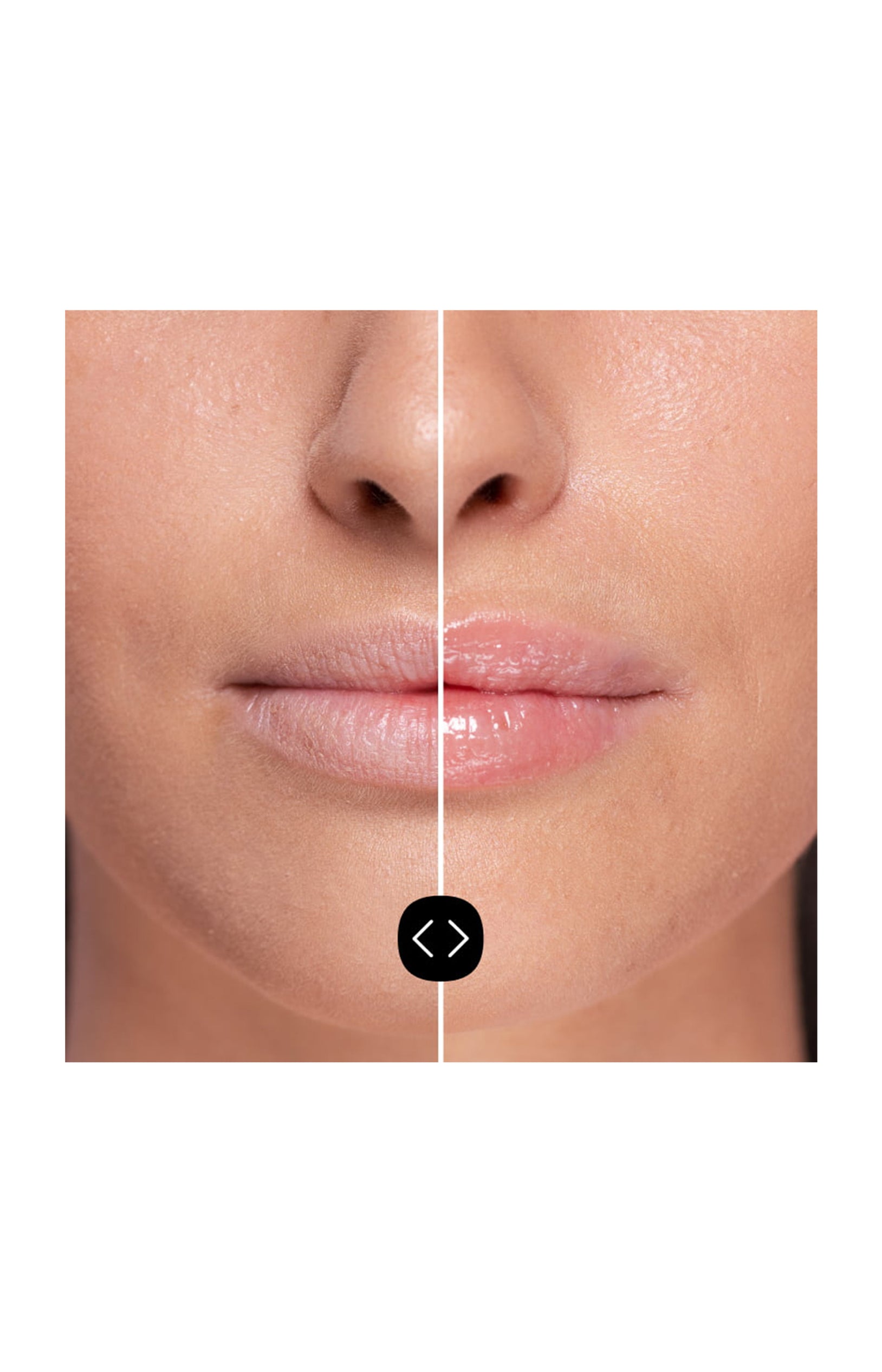 Gloss repulpant -  Acide hyaluronique - 5 ml