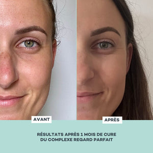Complexe Regard Parfait - 7 jours
