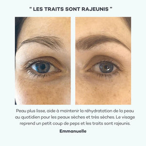 Absolu Hyaluronique