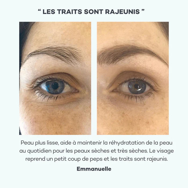 Absolu Hyaluronique