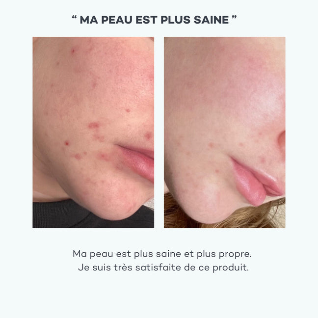 Absolu de Zinc