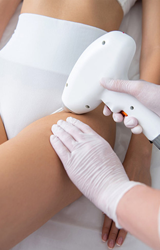 Epilation Laser - 6 séances jambes entières