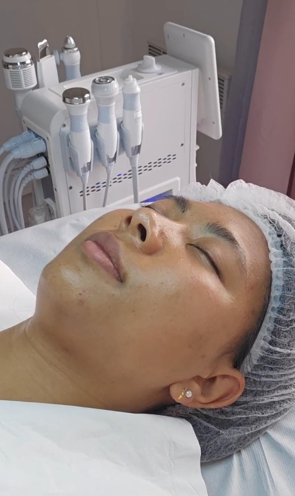 Soin Hydrapeel facial - 1h