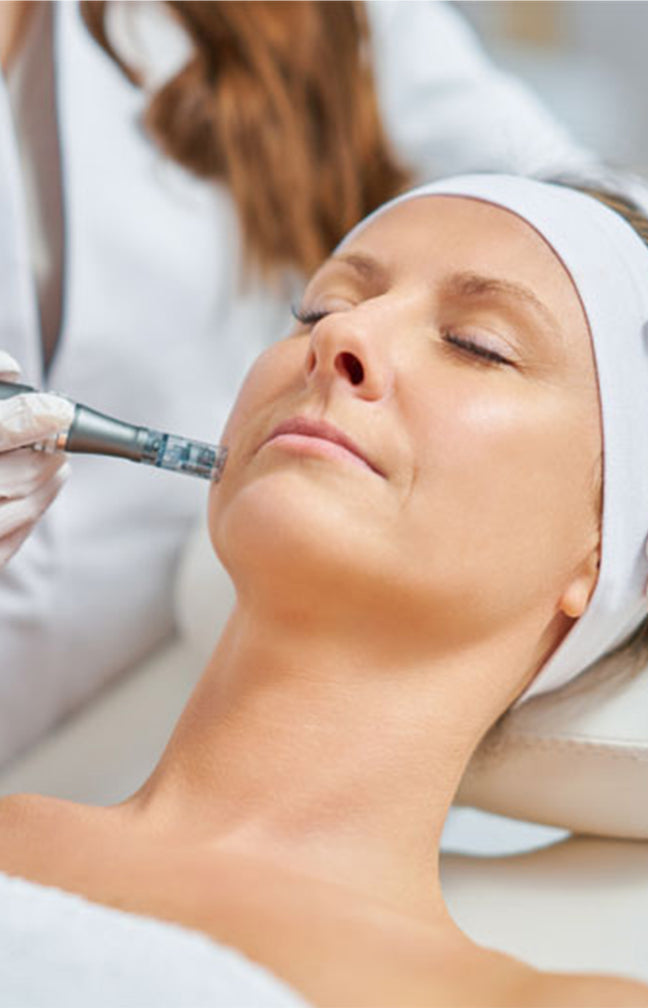 Microneedling
