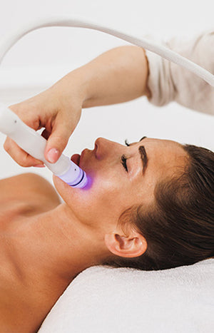 Microneedling sur mesure
