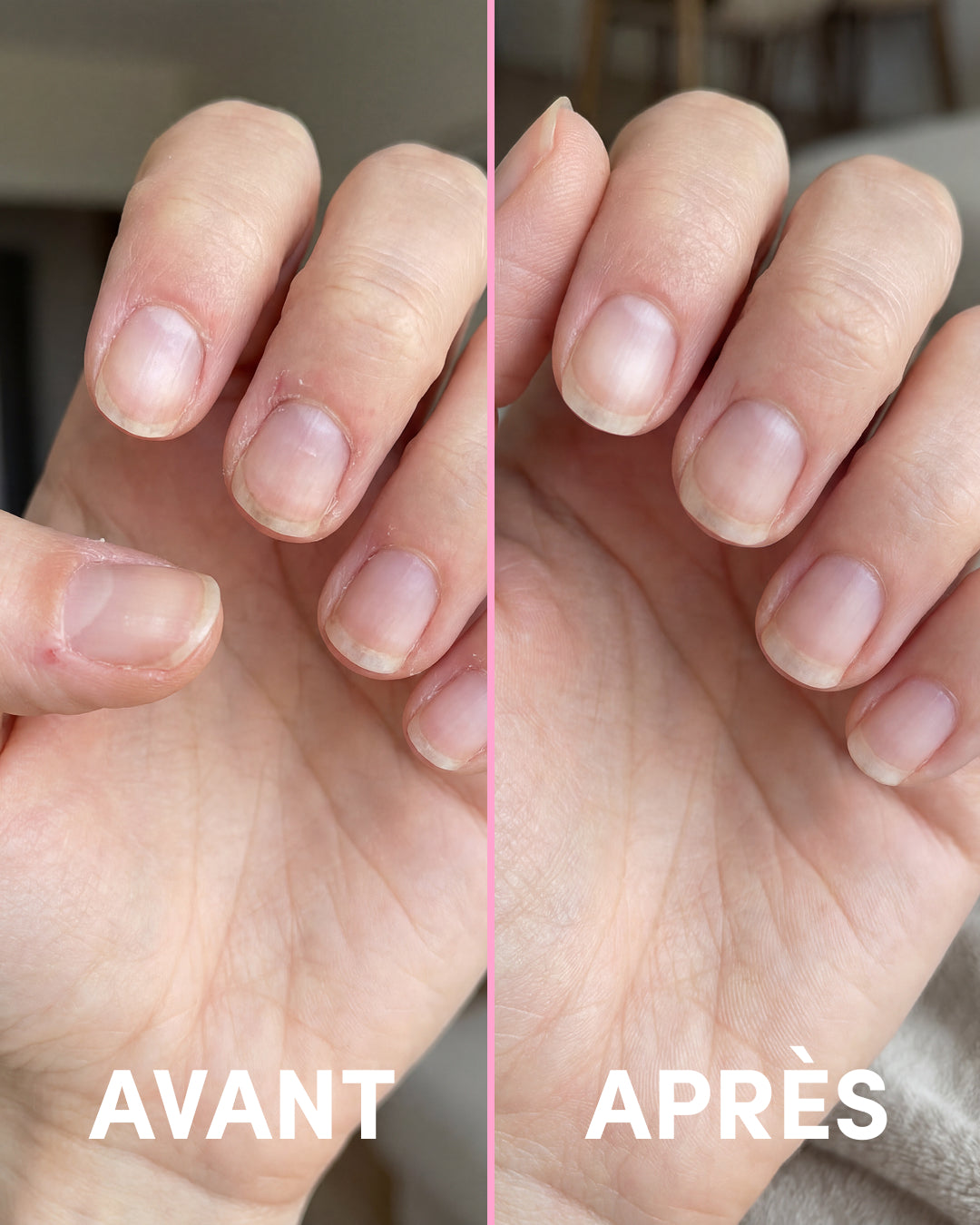 Sérum Ongles et Cuticules