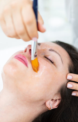Soin visage Peeling