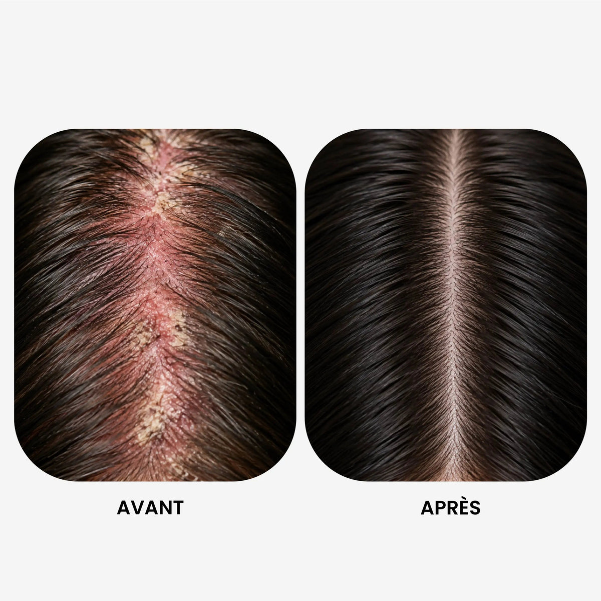 Shampoing Régénérant Cuir Chevelu Sensible - Sans Sulfate
