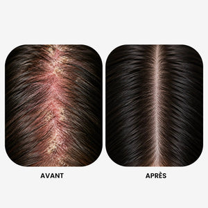 Shampoing Régénérant Cuir Chevelu Sensible - Sans Sulfate