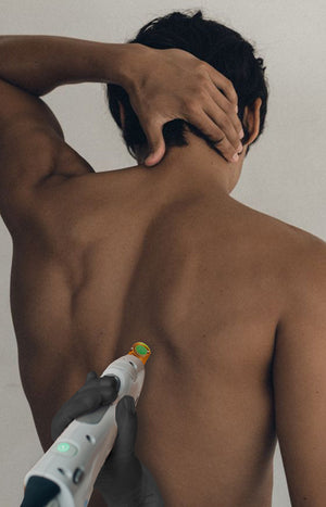 Epilation laser Dos entier 3 séances - Homme