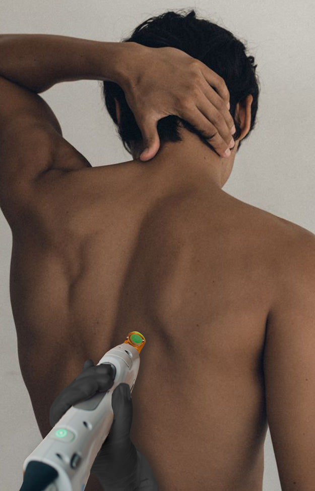 Epilation laser Dos entier 3 séances - Homme
