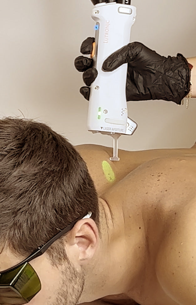 Epilation laser Nuque 3 séances - Homme