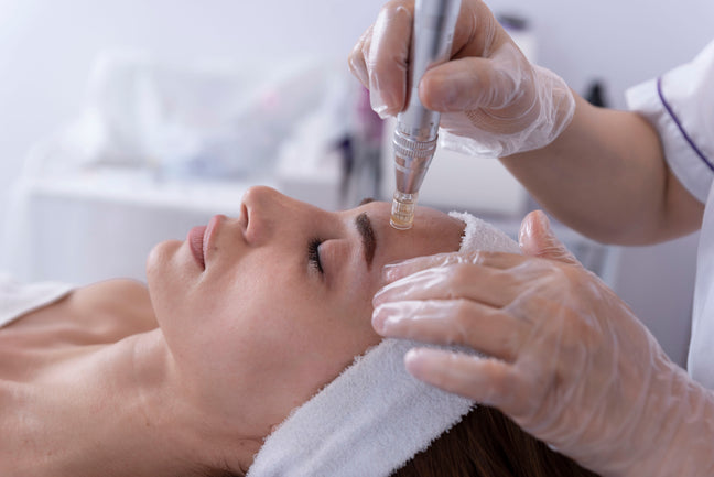 Microneedling - 30mn