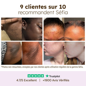 Huile Visage Nourrissante au Curcuma