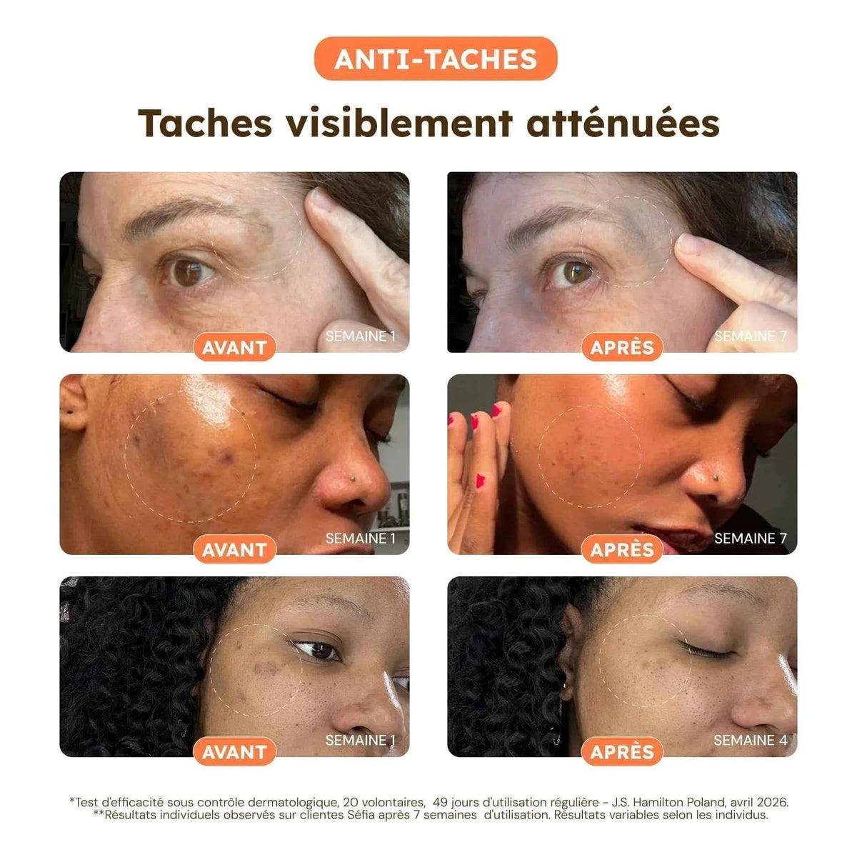 Routine Anti-Taches - Cure 60 Jours