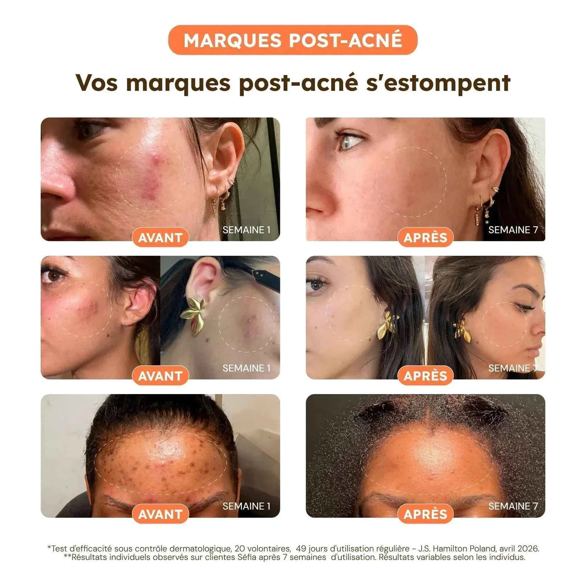 Routine Anti-Taches - Cure 60 Jours