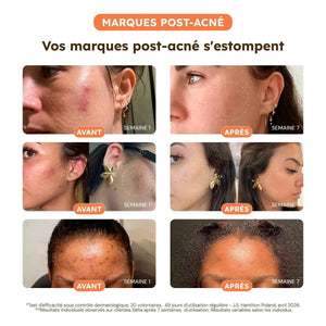 Routine Anti-Taches - Cure 60 Jours