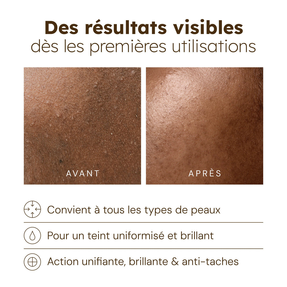 Huile Visage Nourrissante au Curcuma