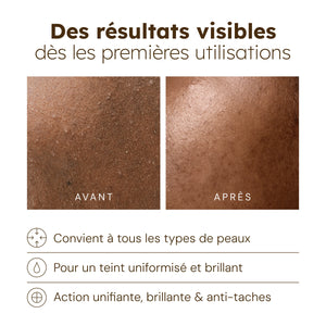 Huile Visage Nourrissante au Curcuma