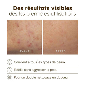Nettoyant Éclat au Curcuma